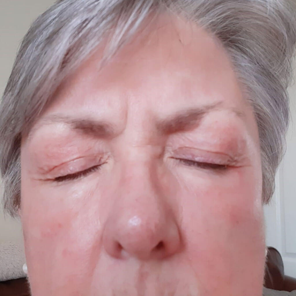 Eye color case study picture